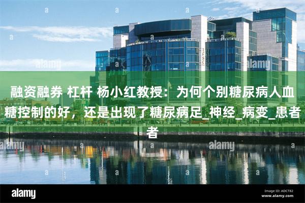 融资融券 杠杆 杨小红教授：为何个别糖尿病人血糖控制的好，还是出现了糖尿病足_神经_病变_患者